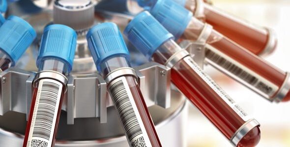 Blood test tubes in centrifuge. Medical laboratory concept.